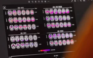 “صحة الدماغ تبدأ من الألحان”.. الموسيقى تنضم لقائمة الأنشطة الوقائية ضد الخرف