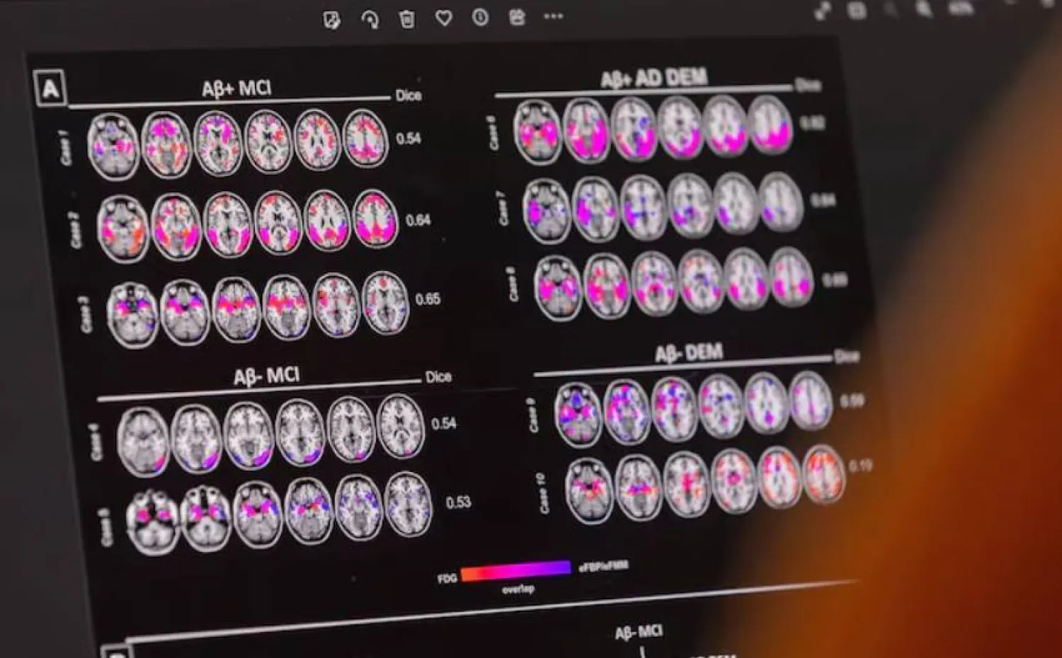 “صحة الدماغ تبدأ من الألحان”.. الموسيقى تنضم لقائمة الأنشطة الوقائية ضد الخرف 