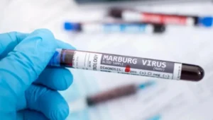 سفارة المملكة في إثيوبيا تحذر من السفر إلى مناطق تفشي “ماربورغ”