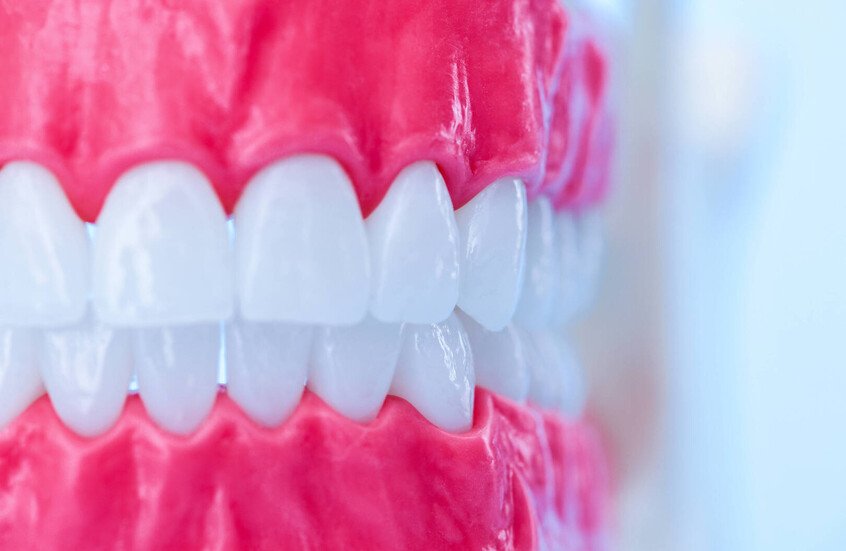 جمعية القلب الأمريكية تحذر: التهاب اللثة يهدد سلامة الشرايين 