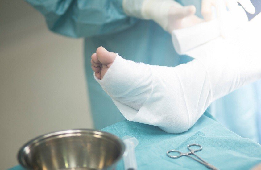 جراحة روسية لدمج الأطراف الاصطناعية مباشرة في النسيج العظمي 