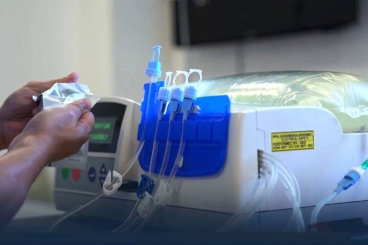 لحماية الذاكرة.. “الغسيل البريتوني” يتفوق في حفظ القدرات الذهنية لمرضى الكلى 