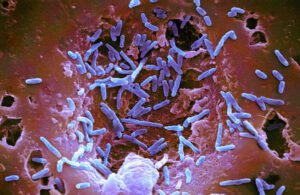 تحذير من منتجات خضراء ملوثة بالسالمونيلا