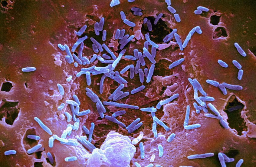 تحذير من منتجات خضراء ملوثة بالسالمونيلا 