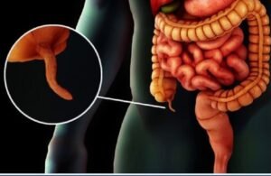 خزان المناعة الخفي.. الزائدة الدودية “مستودع” للبكتيريا النافعة وليست عضواً زائداً