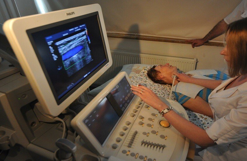 تنبيه عصبي: الصداع والدوخة قد يكشفان تضيق أوعية الرقبة 