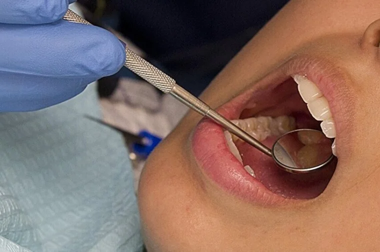 دراسة حديثة: صحة الفم والأسنان ركيزة أساسية لحماية القلب والشرايين 