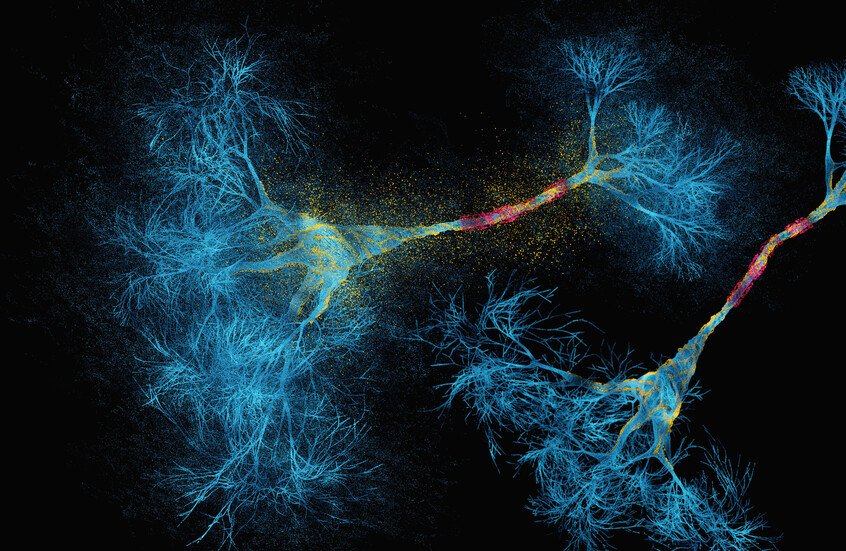 الذكاء الاصطناعي يكتشف وجهين جديدين للتصلب المتعدد 