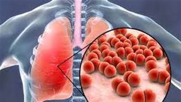 “رسائل الحياة”.. التقنية البسيطة تضاعف فرص تعافي مرضى السل 