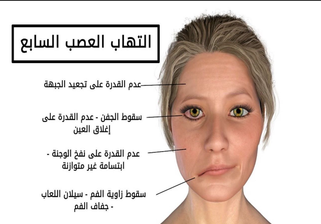 لغز “أبا الوجيه”.. البرد بريء حتى تثبت إدانته 