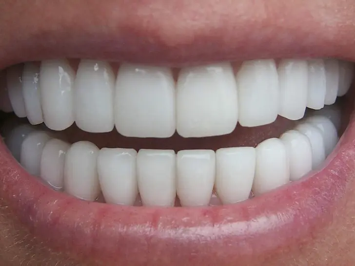 نظافة الأسنان تمنحك عقدًا إضافيًا من العمر وتحمي الدماغ من “الخرف” 