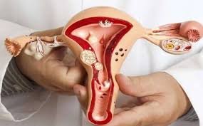 خارطة طريق صحية للوقاية من الالتهابات والتمييز بين أنواع الطلق 1 التهابات مهبلية