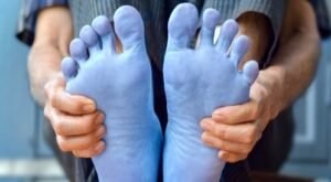 سر برودة الأطراف وعلاقتها بالأمراض المزمنة