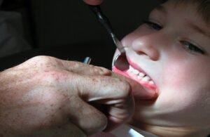 دراسة أمريكية: نقص “الليكوبين” يرفع خطر أمراض الفم لثلاثة أضعاف