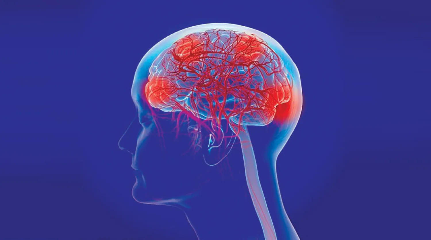 أدوية شائعة تثير الشكوك حول علاقتها بخطر الإصابة بالخرف 