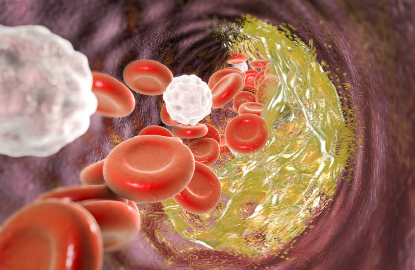 زلزال في الشرايين.. النوبة القلبية “حوار” خاطئ بين القلب والدماغ 