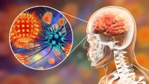 خطر في وادي الصدع: سلسلة افتراس تثير المخاوف من فيروس ماربورغ 1 نيباه جائجة